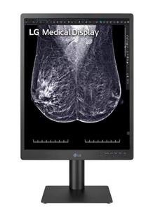 MONITOR DIAGNOSTICO LG 21" 4:3 5MPX 21HQ613D