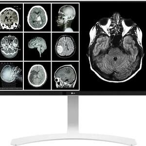 MONITOR REVISION CLINICA LG 27" W 8MPX 27HJ712-W